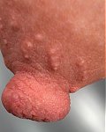 Richtig lange Monsternippel und ungewöhnlich geformte Brustwarzen.